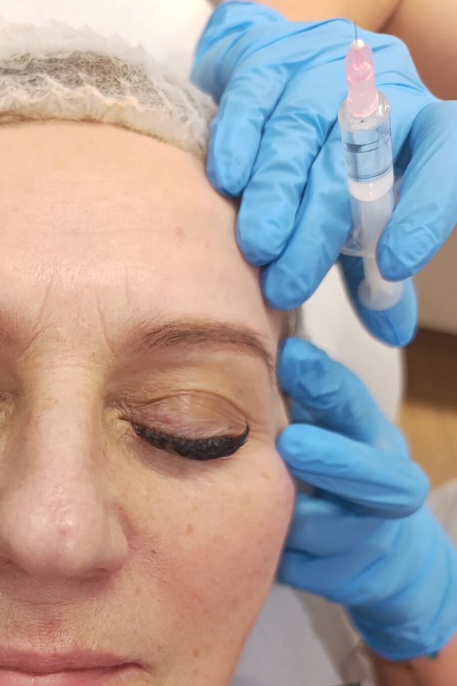Stymulatory Mezoterapia Tropokolagen Elblag
